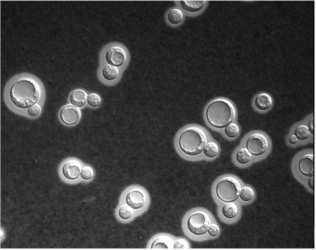 Cryptococcus Neoformans 